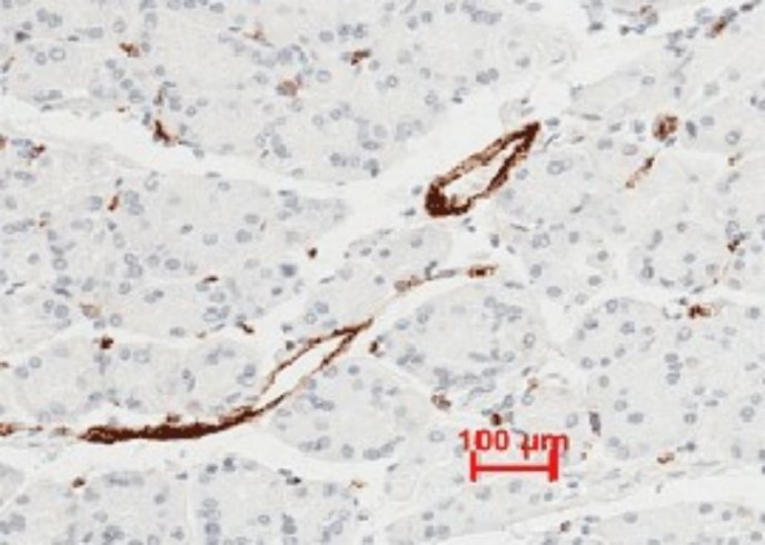 Recombinant vWF Monoclonal Antibody - small - 2