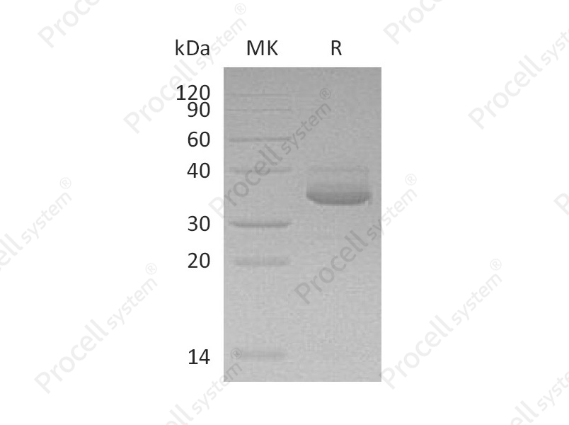 IP-10/CRG-2/CXCL10 (C-Fc-6His), Human, Recombinant