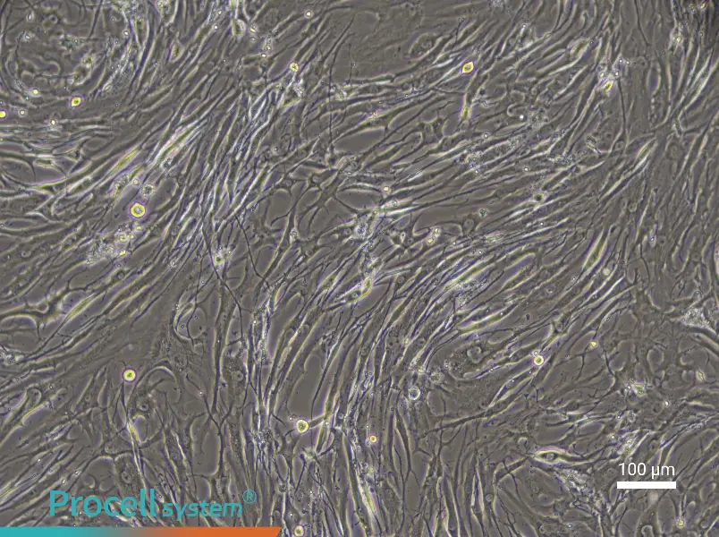 Human Endplate Chondrocyte Complete Medium - 3