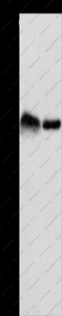 CRELD1 Polyclonal Antibody - 1