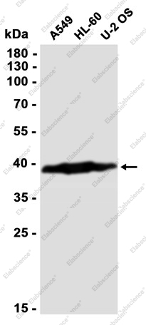 Recombinant CAB39 Monoclonal Antibody - 3