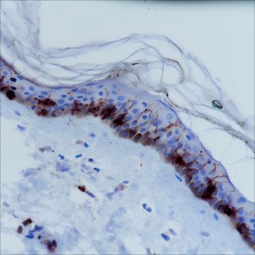 Recombinant CD1a Monoclonal Antibody - 2