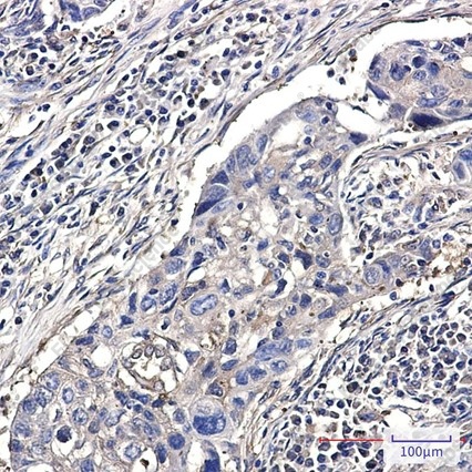 Recombinant Destrin Monoclonal Antibody - 2