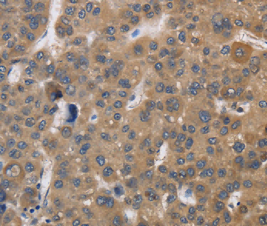 SDCCAG3 Polyclonal Antibody - 2