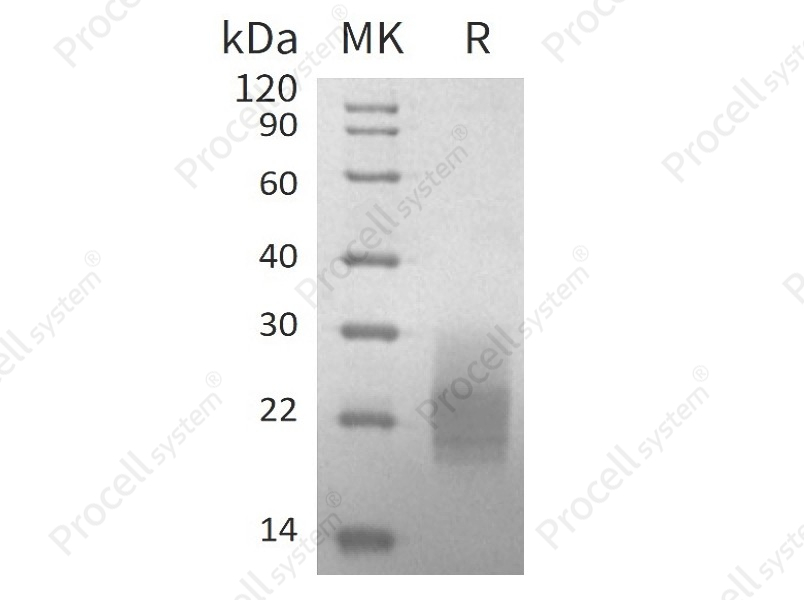 GM-CSF/CSF2 (C-6His), Mouse, Recombinant