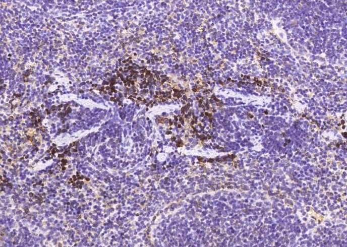 Recombinant MAP2 Monoclonal Antibody-searchlist-1
