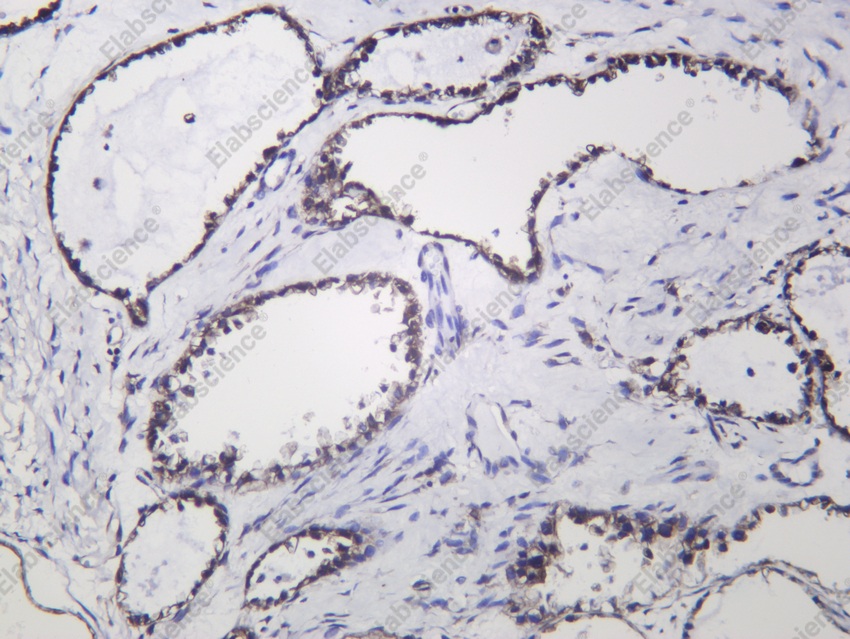 Recombinant eIF4G1 Monoclonal Antibody - 2