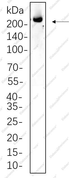 Recombinant ALK Monoclonal Antibody - 1