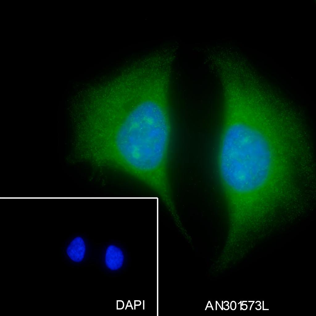 Recombinant ELP3 Monoclonal Antibody - small - 4