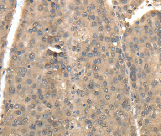 TXN Polyclonal Antibody - 2
