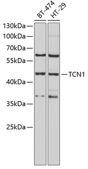 Western blot analysis of extracts of various cell lines using TCN1 Polyclonal Antibody at 1:1000 dilution.