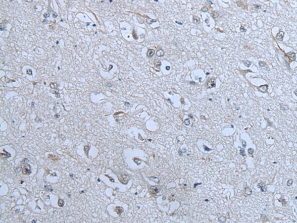 Immunohistochemistry of paraffin-embedded Human brain tissue  using ZNF703 Polyclonal Antibody at dilution of 1:55(?200)