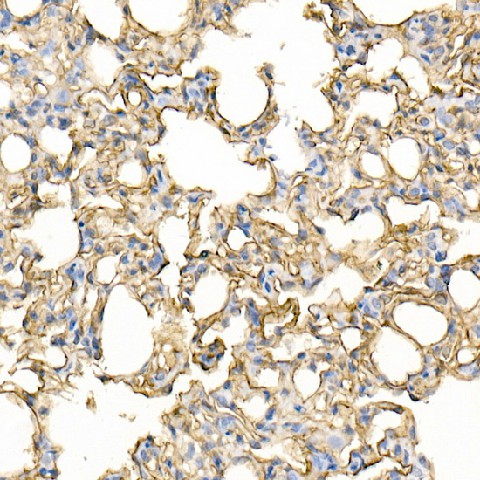 Immunohistochemistry of paraffin-embedded rat lung using ICAM1 Polyclonal Antibody at dilution of 1:100 (40x lens).Perform high pressure antigen retrieval with 10 mM citrate buffer pH 6.0 before commencing with IHC staining protocol.