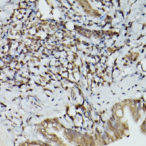 Immunohistochemistry of paraffin-embedded rat lung using TFEB Polyclonal Antibody at dilution of 1:100 (40x lens).Perform high pressure antigen retrieval with 10 mM citrate buffer pH 6.0 before commencing with IHC staining protocol.