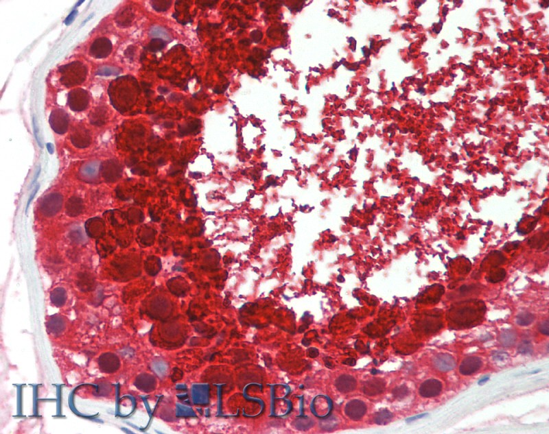 Immunohistochemistry of paraffin-embedded Testis tissue using ASPN Polyclonal Antibody at dilution of 1:60 (Elabscience Product Detected by Lifespan).