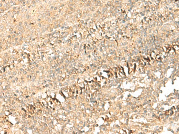 Immunohistochemistry of paraffin-embedded Human tonsil tissue  using PSD4 Polyclonal Antibody at dilution of 1:50(?200)