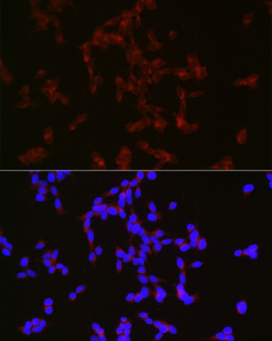 NPY Polyclonal Antibody - small - 3