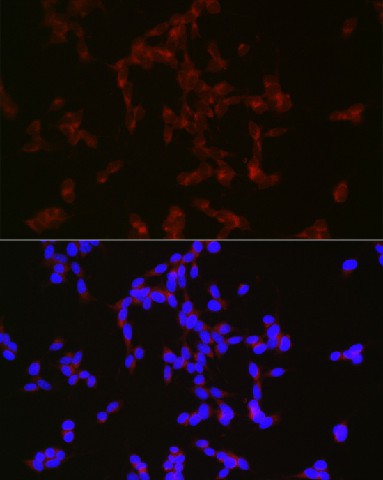 Immunofluorescence analysis of SH-SY5Y cells using NPY Polyclonal Antibody at dilution of 1:50 (40x lens). Blue: DAPI for nuclear staining.