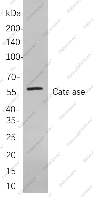 Recombinant Catalase Monoclonal Antibody - 1