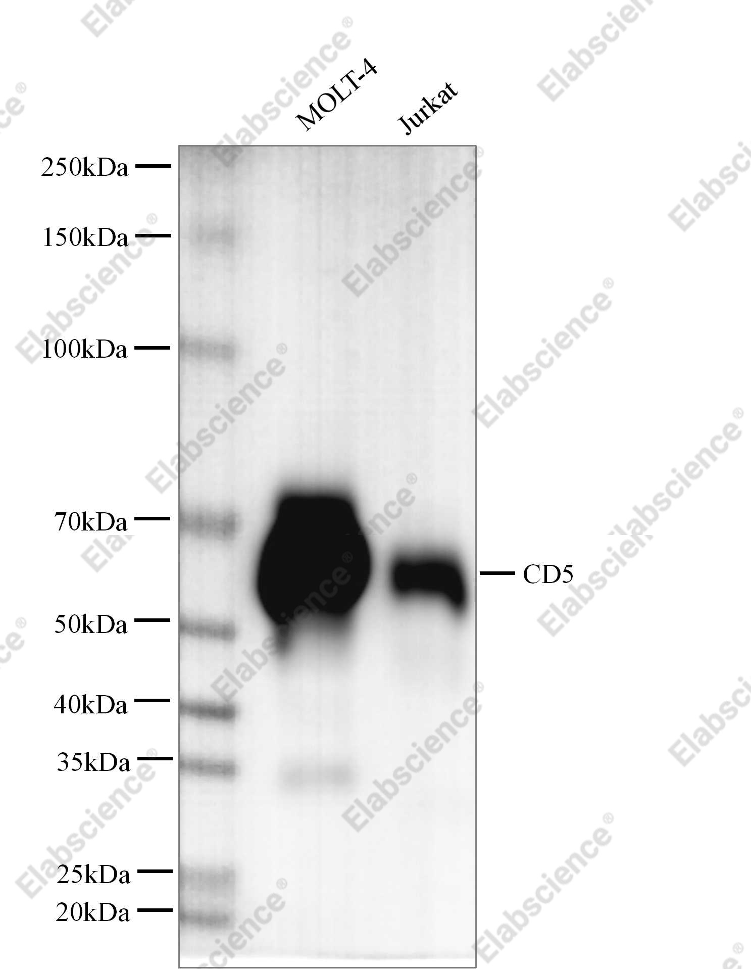 Recombinant CD5/Cluster of Differentiation 5 Monoclonal Antibody - 2