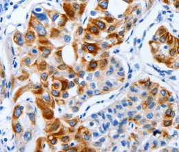 BPIFB3 Polyclonal Antibody - 3
