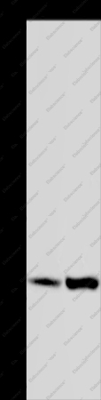 GAB2 Polyclonal Antibody - 1