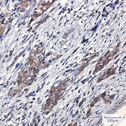 Recombinant SARA Monoclonal Antibody - 2