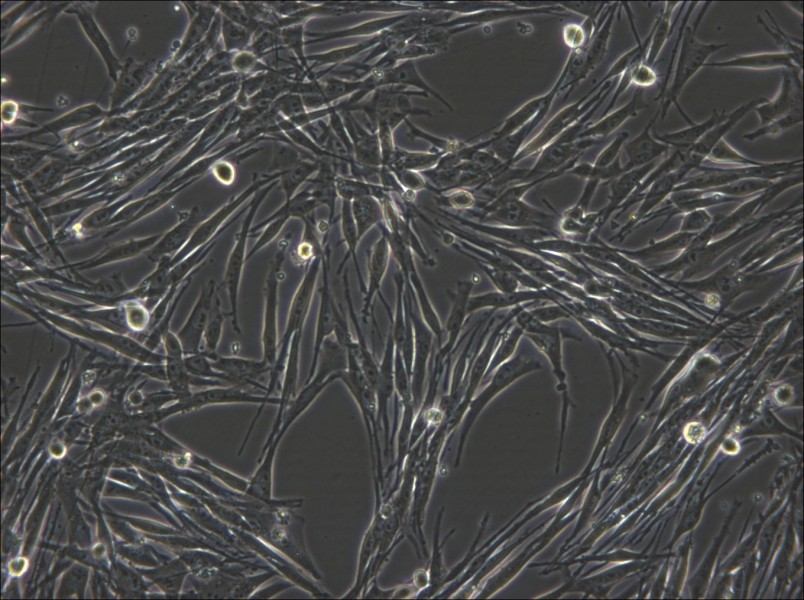 MeWo Cell Complete Medium - 5