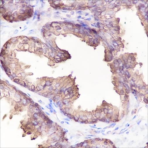 Recombinant PAP Monoclonal Antibody - small - 2