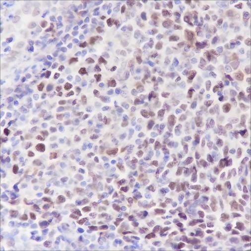 Recombinant MCM5 Monoclonal Antibody - 2