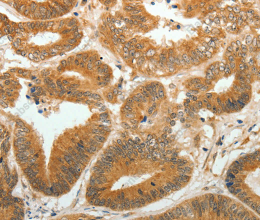 AKR1C1 Polyclonal Antibody - 2