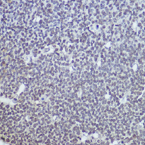 Immunohistochemistry of paraffin-embedded mouse embryos using TET1 Polyclonal Antibody at dilution of 1:100 (40x lens).Perform high pressure antigen retrieval with 10 mM citrate buffer pH 6.0 before commencing with IHC staining protocol.