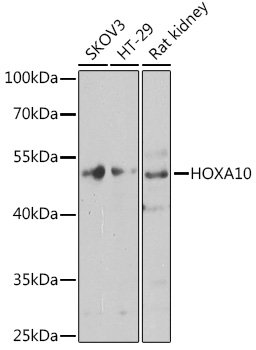 Western blot analysis of extracts of various cell lines using HOXA10 Polyclonal Antibody at 1:1000 dilution.