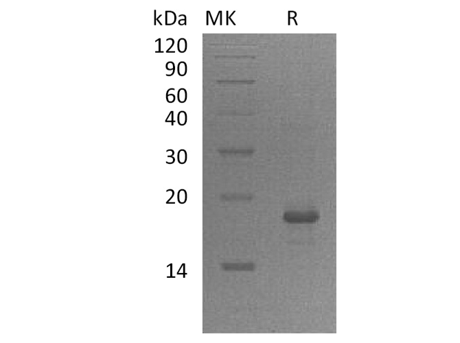 Recombinant Human GADD45A/DDIT-1 Protein (His Tag)