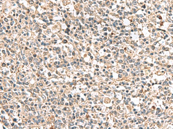 Immunohistochemistry of paraffin-embedded Human tonsil tissue  using PTPRS Polyclonal Antibody at dilution of 1:110(?200)