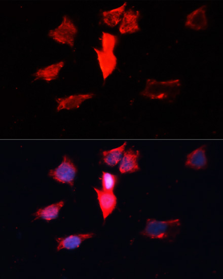 Immunofluorescence analysis of HeLa cells using CALM3 Polyclonal Antibody at dilution of 1:100. Blue: DAPI for nuclear staining.