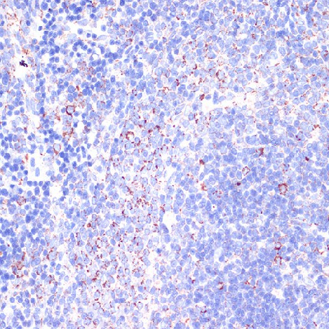 Immunohistochemistry of paraffin-embedded Rat spleen using CD18 Polyclonal Antibody at dilution of  1:100 (40x lens).