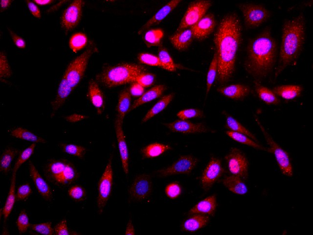 Immunofluorescence analysis of PC-3 cells using p16 Polyclonal Antibody at dilution of 1:100