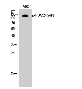 Western Blot analysis of VEC cells with Phospho-HDAC5 (Ser498) Polyclonal Antibody at dilution of 1:500