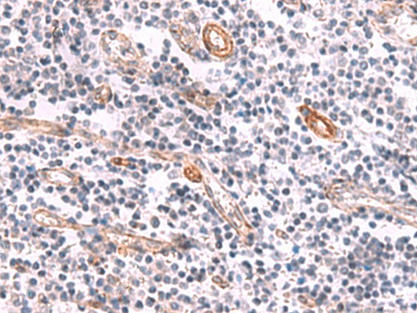 KCNK15 Polyclonal Antibody - small - 2