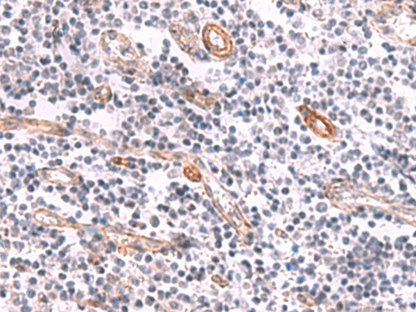 Immunohistochemistry of paraffin-embedded Human tonsil tissue  using KCNK15 Polyclonal Antibody at dilution of 1:45(?200)