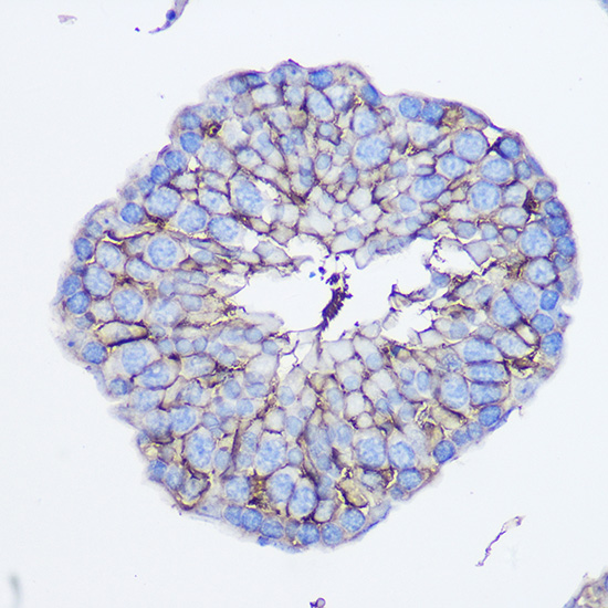 Immunohistochemistry of paraffin-embedded mouse testis using CD73/NT5E Polyclonal Antibody at dilution of 1:100 (40x lens).Perform microwave antigen retrieval with 10 mM PBS buffer pH 7.2 before commencing with IHC staining protocol.