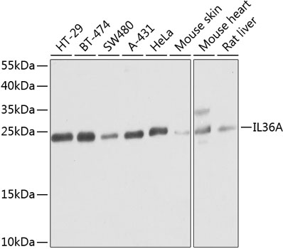 Western blot analysis of extracts of various cell lines using IL36A Polyclonal Antibody at dilution of 1:1000.