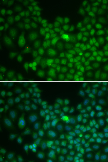 Immunofluorescence analysis of U2OS cells using CLU Polyclonal Antibody