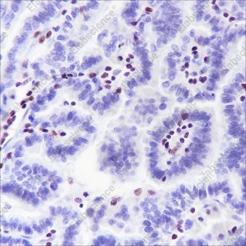 Recombinant IKAROS Monoclonal Antibody - 3