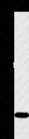 SULT2A1 Polyclonal Antibody - 1
