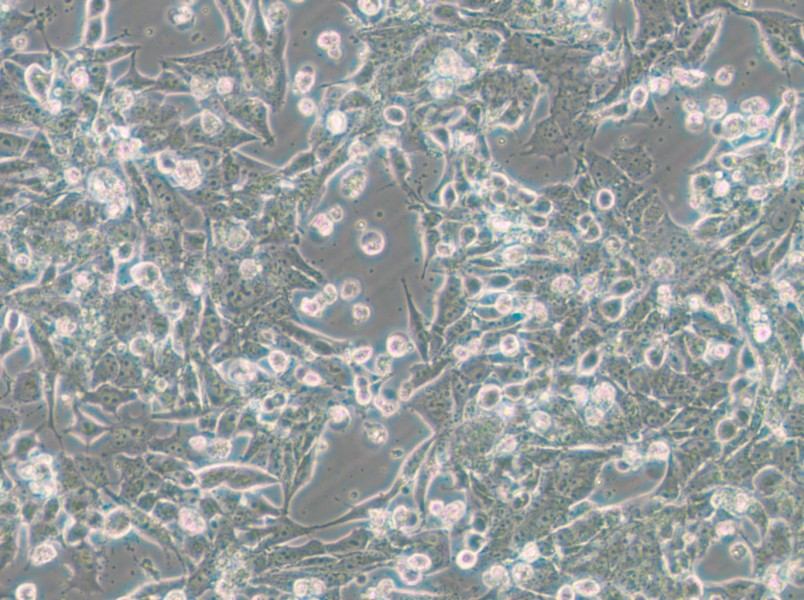 SNU-398 Cell Complete Medium - small - 10