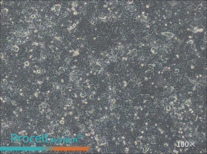 NTERA-2 Cell Complete Medium - 1