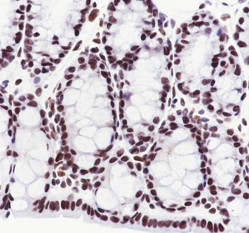 Recombinant CHD4 Monoclonal Antibody - 3