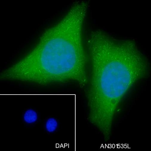 Recombinant GNB2 Monoclonal Antibody - small - 2